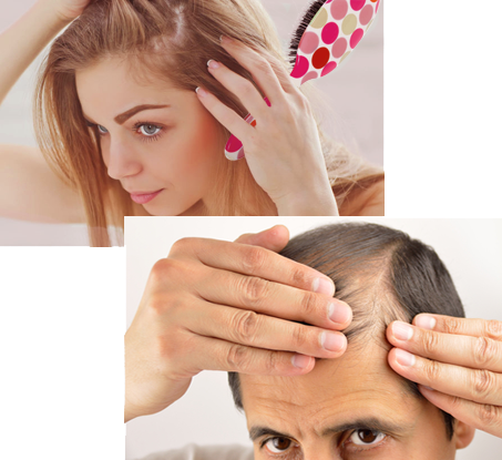 hair loss treatments manhattan