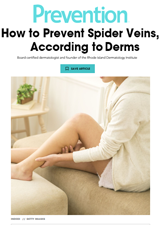 How to Prevent Spider Veins, According to Dermatologists