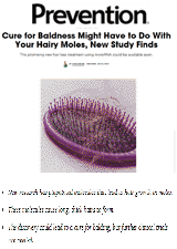 Cure for Baldness Might Have to Do With Your Hairy Moles Study Finds