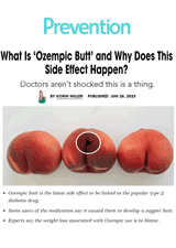 What is Ozempic Butt - And Why Does this Side Effect Happen ?