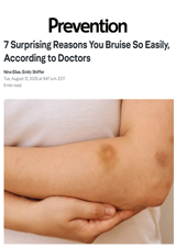 7 Surprising Reasons You Bruise Easily According to Derms