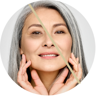 undereye treatment manhattan