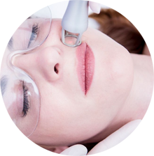 CO2 Laser Treatments Manhattan