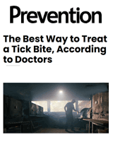 How to Treat a Tick Bite Correctly, According to The Top US Medical Doctors