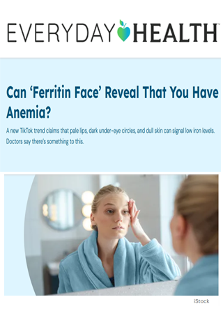 Can ‘Ferritin Face’ Reveal That You Have Anemia? Doctors Say Yes!
